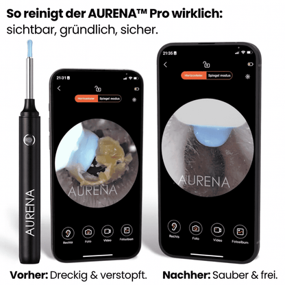 Aurena™ Pro
